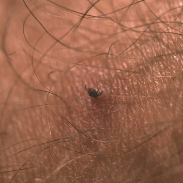 Flåtfjerner - Lifesystems Tick Remover Card - Image 3